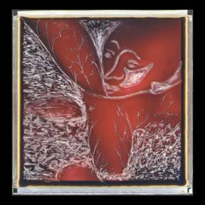 red amoeba